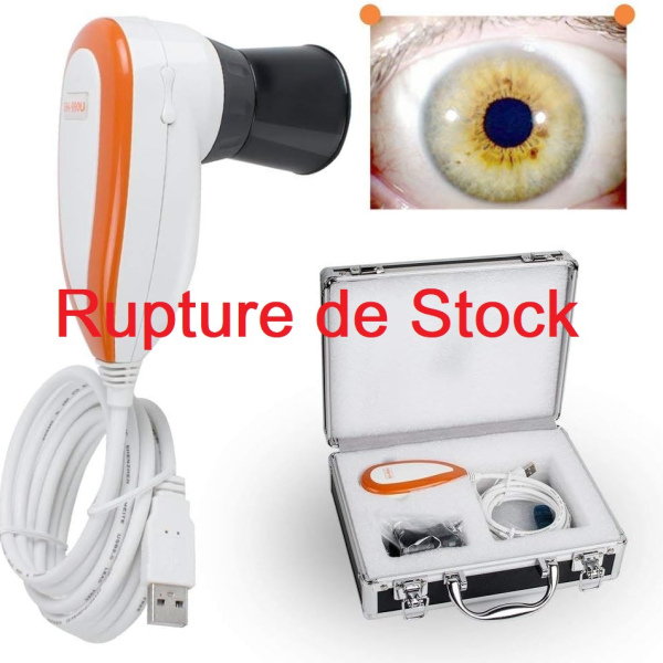 Iriscope USB (Rupture)